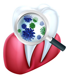 牙龈牙齿上的细菌矢量素材