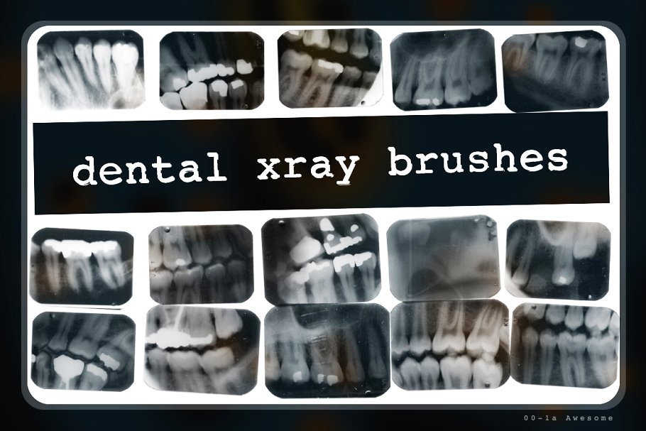 牙科X光射线影像PS笔刷 Dental X-ray Brushes插图