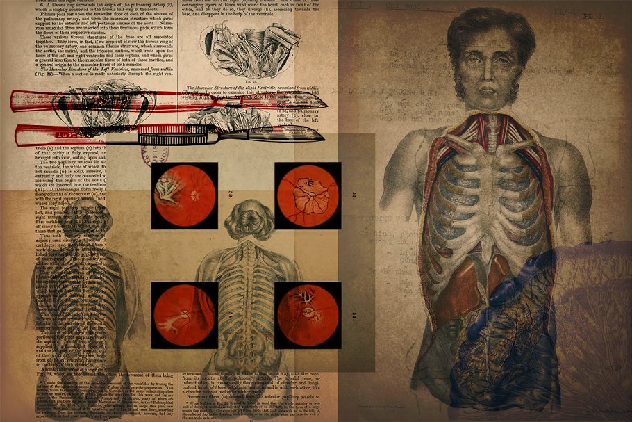 旧时代解剖医学插图素材 Medical Art | 110 EPS, PNG and JPG’s插图(1)