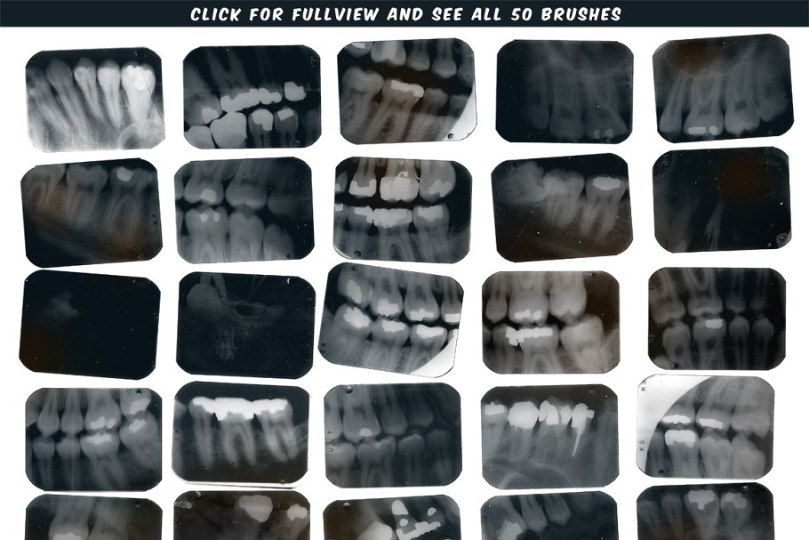 牙科X光射线影像PS笔刷 Dental X-ray Brushes插图(2)