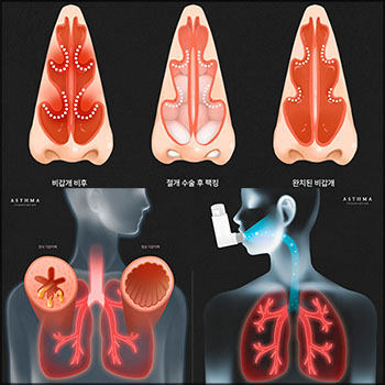 9款人体呼吸系统呼吸道医学透视图P